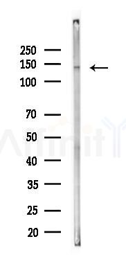 JIP3 Antibody - Western blot analysis of lysates from K562 cells(LPS 4h treatment), using JIP3 Antibody at 1/1000 dilution.