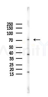 ALS2CR11 Antibody - Western blot analysis of lysates from COLO205 cells(LPS 4h treatment), using ALS2CR11 Antibody at 1/1000 dilution.