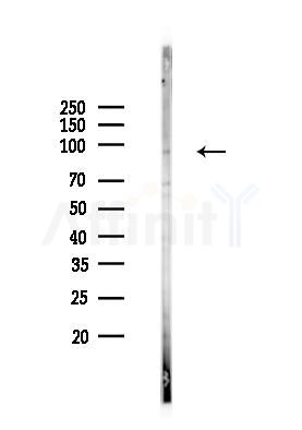 NUP93 Antibody - Western blot analysis of lysates from K562 cells(heat-shock 45min treatment), using NUP93 Antibody at 1/1000 dilution.