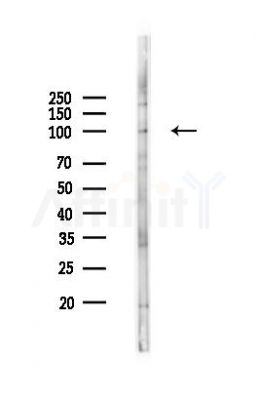 KCNH1 Antibody - Western blot analysis of lysates from K562 cells(heat-shock 45min treatment), using KCNH1 Antibody at 1/1000 dilution.