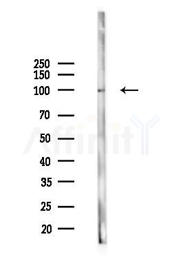 KCNH1 Antibody - Western blot analysis of lysates from B16F10-LUC cells(LPS 4h treatment), using KCNH1 Antibody at 1/1000 dilution.