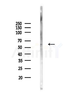 KCNV2 Antibody - Western blot analysis of lysates from K562 cells(heat-shock 45min treatment), using KCNV2 Antibody at 1/1000 dilution.