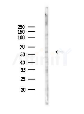 A26B1 Antibody - Western blot analysis of lysates from K562 cells(heat-shock 45min treatment), using A26B1 Antibody at 1/1000 dilution.