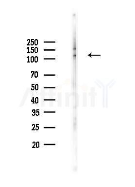RAB3GAP1 Antibody - Western blot analysis of lysates from K562 cells(heat-shock 45min treatment), using RAB3GAP1 Antibody at 1/1000 dilution.