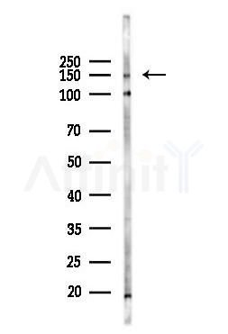 SFRS8 Antibody - Western blot analysis of lysates from B16F10-LUC cells(LPS 4h treatment), using SFRS8 Antibody at 1/1000 dilution.
