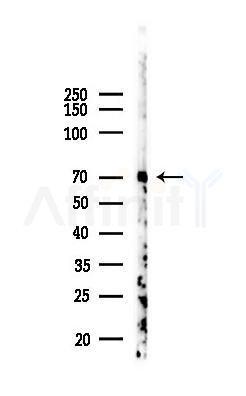BAI1 Antibody - Western blot analysis of lysates from COLO205 cells(heat-shock 45min treatment), using BAI1 Antibody at 1/1000 dilution.