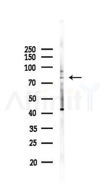 FZD3 Antibody - Western blot analysis of lysates from PC12 cells(heat-shock 45min treatment), using FZD3 Antibody at 1/1000 dilution.