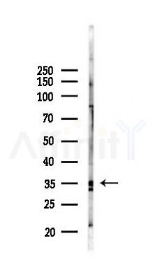 OR11G2 Antibody - Western blot analysis of lysates from PC12 cells(heat-shock 45min treatment), using OR11G2 Antibody at 1/1000 dilution.