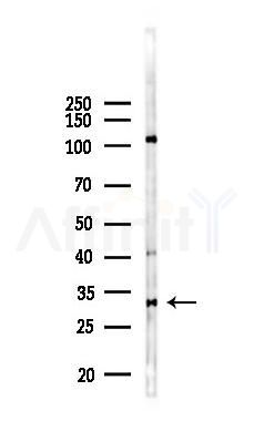OR2T2/2T35 Antibody - Western blot analysis of lysates from COLO205 cells(heat-shock 45min treatment), using OR2T2/2T35 Antibody at 1/1000 dilution.