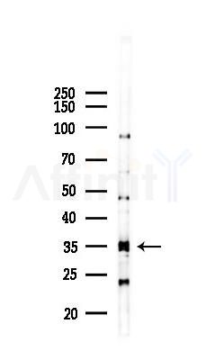 OR89 Antibody - Western blot analysis of lysates from COLO205 cells(heat-shock 45min treatment), using OR89 Antibody at 1/1000 dilution.