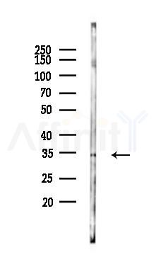 TRADD Antibody - Western blot analysis of lysates from Rat spleen, using TRADD Antibody at 1/1000 dilution.