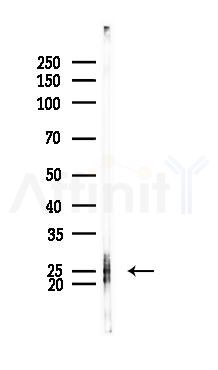 TMS1/ASC Antibody - Western blot analysis of lysates from K562 cells(UV 30min treatment), using TMS1/ASC Antibody at 1/1000 dilution.