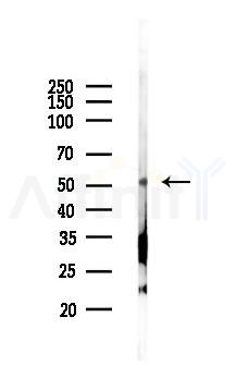 PAH Antibody - Western blot analysis of lysates from Hela cells(LPS 4h treatment), using PAH Antibody at 1/1000 dilution.