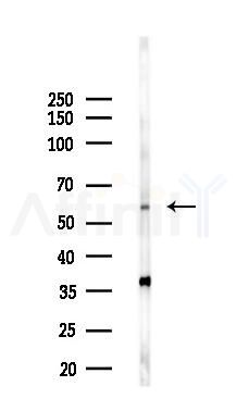 MUTYH Antibody - Western blot analysis of lysates from 293 cells(LPS 4h treatment), using MUTYH Antibody at 1/1000 dilution.