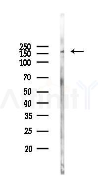 ITGAL Antibody - Western blot analysis of lysates from Hela cells(LPS 4h treatment), using ITGAL Antibody at 1/1000 dilution.