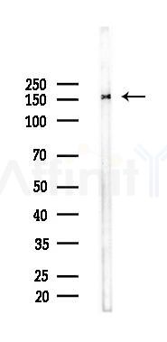 ITGAL Antibody - Western blot analysis of lysates from 293 cells(LPS 4h treatment), using ITGAL Antibody at 1/1000 dilution.