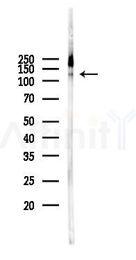 DDB1 Antibody - Western blot analysis of lysates from K562 cells(heat-shock 45min treatment), using DDB1 Antibody at 1/1000 dilution.