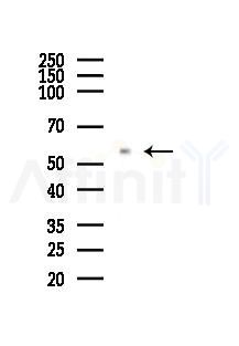 IMPDH2 Antibody - Western blot analysis of lysates from Mouse brain, using IMPDH2 Antibody at 1/1000 dilution.