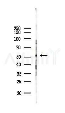 MLKL Antibody - Western blot analysis of lysates from COLO205 cells(starvation 24h treatment), using MLKL Antibody at 1/1000 dilution.