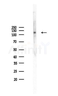 NLRP3 Antibody - Western blot analysis of lysates from 293 cells(heat-shock 45min treatment), using NLRP3 Antibody at 1/1000 dilution.