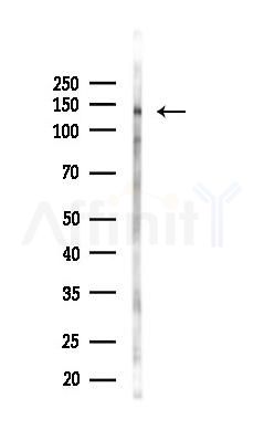 Phospho-PERK (Thr982) Antibody - Western blot analysis of lysates from COLO205 cells(starvation 24h treatment), using Phospho-PERK (Thr982) Antibody at 1/1000 dilution.