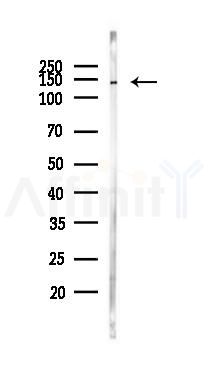Phospho-PERK (Thr982) Antibody - Western blot analysis of lysates from PC12 cells(heat-shock 45min treatment), using Phospho-PERK (Thr982) Antibody at 1/1000 dilution.