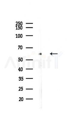 KATNA1 Antibody - Western blot analysis of lysates from 293 cells(LPS 4h treatment), using KATNA1 Antibody at 1/1000 dilution.