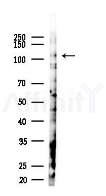 DNA2L Antibody - Western blot analysis of lysates from 293 cells(LPS 4h treatment), using DNA2L Antibody at 1/1000 dilution.