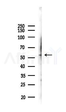 SERPINA10 Antibody - Western blot analysis of lysates from COLO205 cells(heat-shock 45min treatment), using SERPINA10 Antibody at 1/1000 dilution.