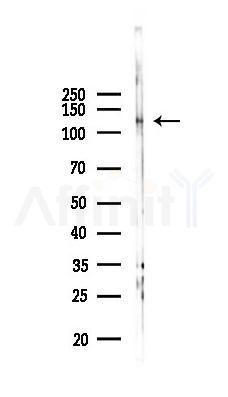PPP4R1 Antibody - Western blot analysis of lysates from COLO205 cells(heat-shock 45min treatment), using PPP4R1 Antibody at 1/1000 dilution.