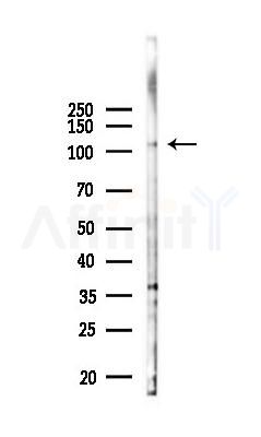 SLC9A1 Antibody - Western blot analysis of lysates from COLO205 cells(heat-shock 45min treatment), using SLC9A1 Antibody at 1/1000 dilution.