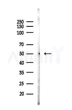 USP34 Antibody - Western blot analysis of lysates from Mouse kidney, using USP34 Antibody at 1/1000 dilution.