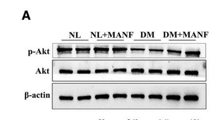 Phospho-AKT1/2/3 (Ser473) Antibody - Figure 6—MANF promoted corneal epithelial wound healing and nerve regeneration through Akt activation.