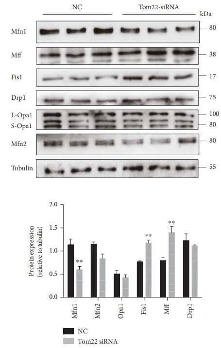 Phospho-DRP1 (Ser616) Antibody - Figure 4: |Effects of Tom22 downregulation on the expression of genes regulating mitochondrial dynamics and on apoptosis in HUVECs.
