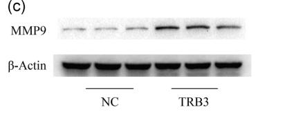 MMP9 Antibody - FIGURE 5 |Target proteins in HBEpC transfected with the TRB3 plasmid.