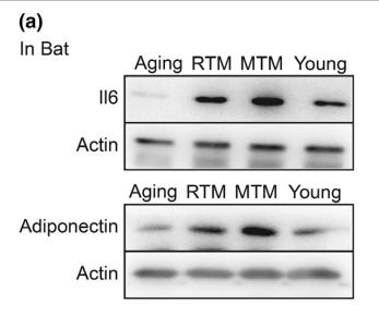 IL6 Antibody - FIGURE 6|RTM significantly improved the levels of important adipokines of aging mice.