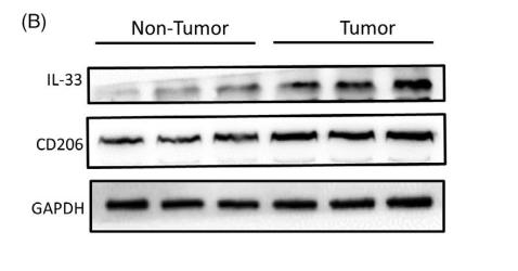 GAPDH Antibody - FIGURE 1|M2 macrophage infiltration and IL-33 production are enhanced with close correlation in oesophageal squamous cell carcinoma (ESCC).