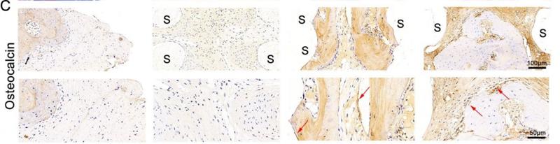 Osteocalcin Antibody - Figure 6.