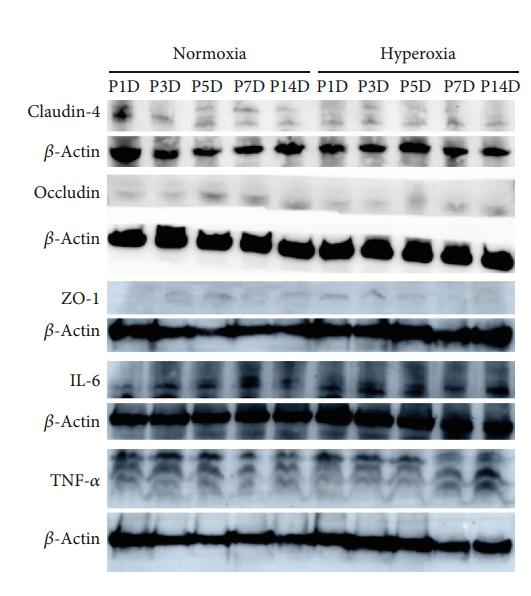 IL6 Antibody - Figure 4:| Tight junction protein expression is positively correlated with that of inflammatory cytokines after neonatal hyperoxia.