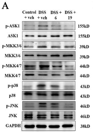 Phospho-JNK1/2/3 (Thr183+Tyr185) Antibody - Fig.