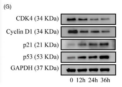 GAPDH Antibody - FIGURE 1| Compression stress induced the senescence of human NP cells.