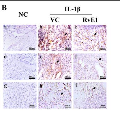 IL1 beta Antibody - Fig.