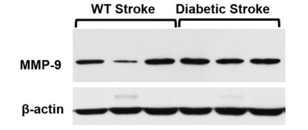 beta Actin Antibody - Fig.