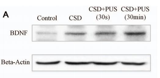 BDNF Antibody - Figure 5.