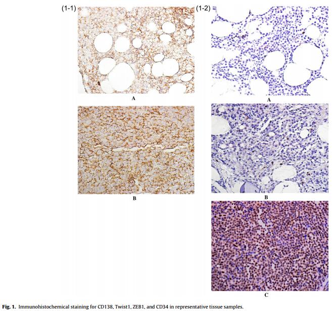 Twist1 Antibody - Fig.