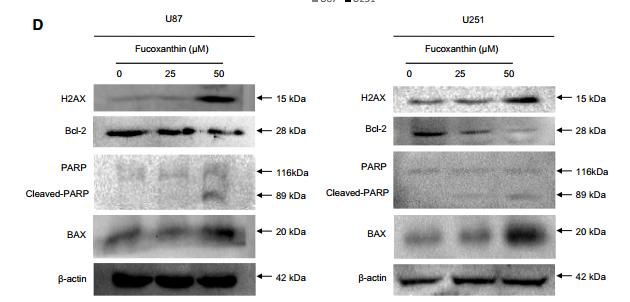 Bcl-2 Antibody - Cell lysates were electrophoresed and apoptotic proteins were detected by their respective specific antibodies in indicated concentrations.