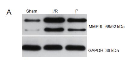 MMP9 Antibody - (A) MMP-9 protein expression.