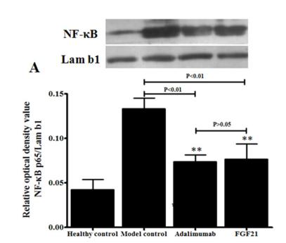 NF-kB p65 Antibody - Fig.