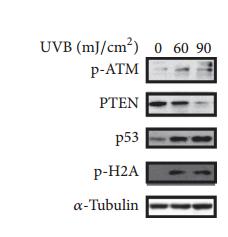 Tubulin alpha Antibody - ????-Tubulin expression was detected as the loading control.