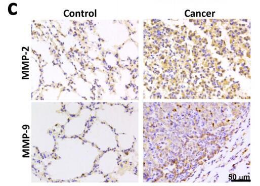 MMP2 Antibody - (c) Representative immunohistochemical staining of MMP2 and MMP9 in AFG1-induced lung adenocarcinoma.